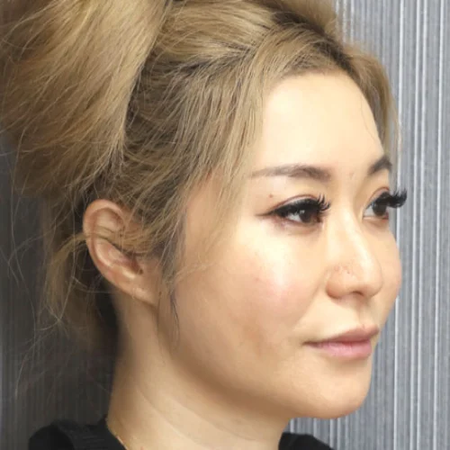 後-Before & After