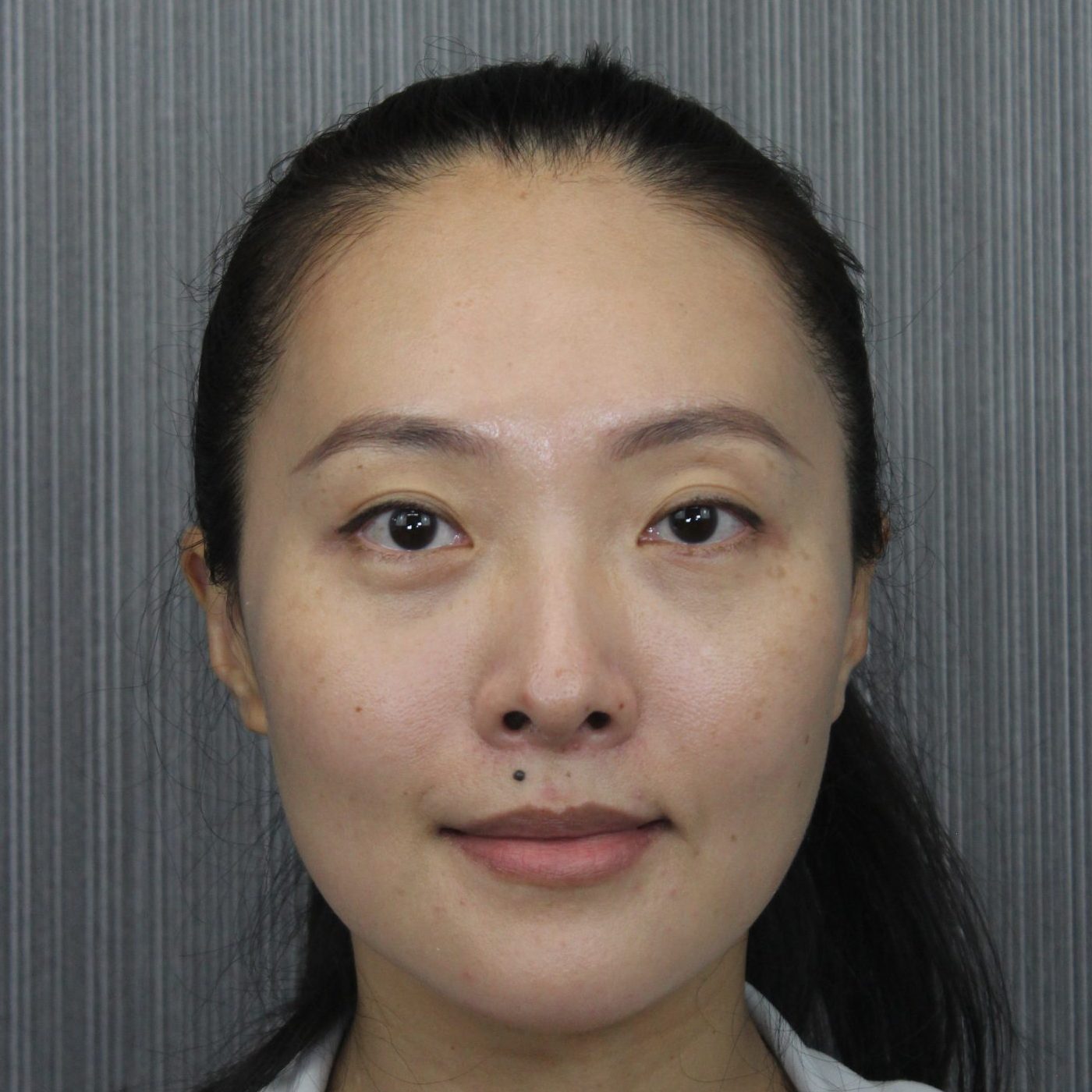 後-Instant Lift; PRM