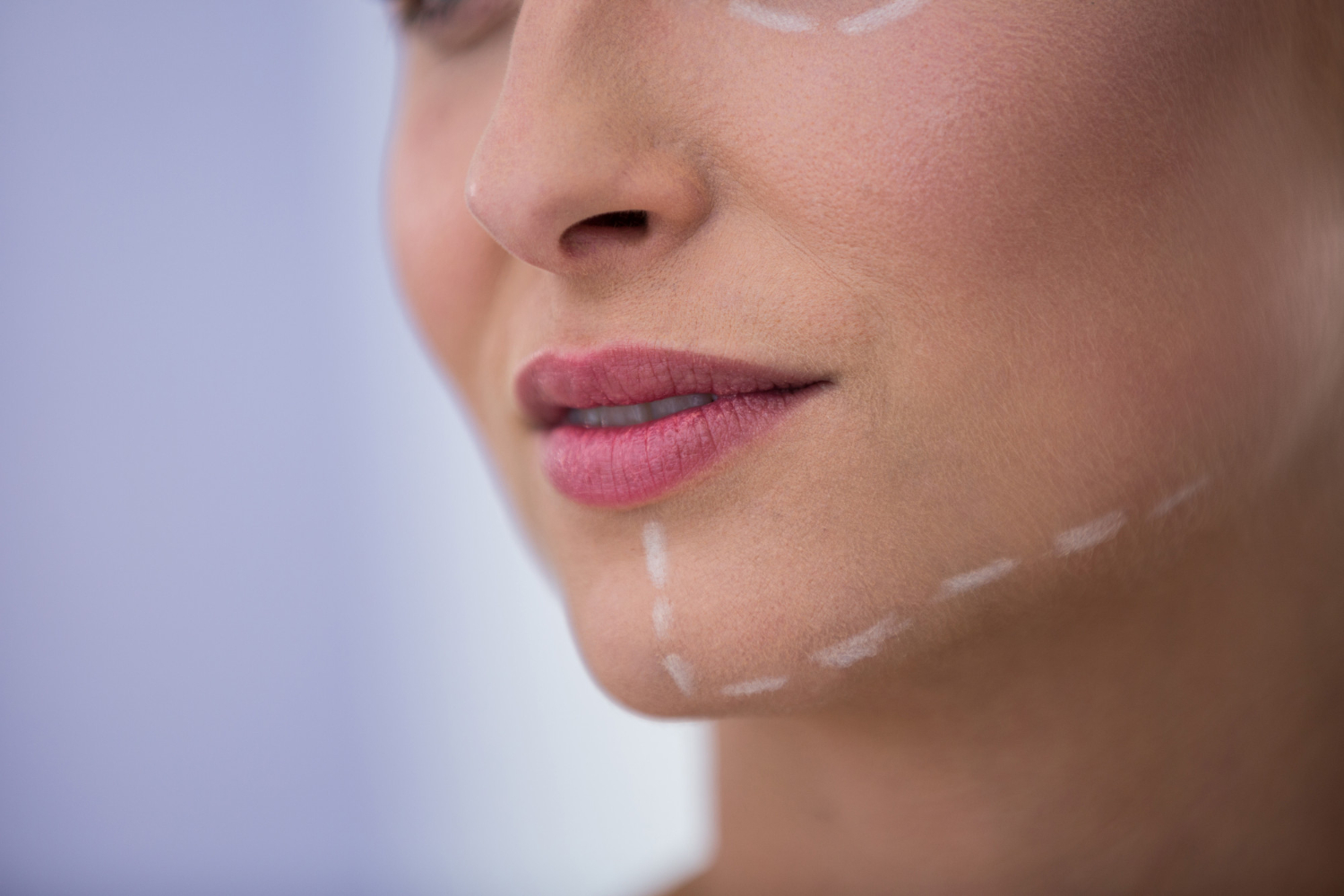The Best Non-Surgical Facelift for Jowls: Transform Your Look Without Surgery