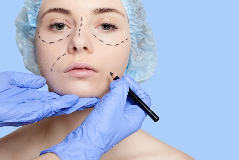 Plastic surgery consultation with a young woman wearing a surgical cap, her face marked with black lines for cosmetic surgery enhancements, as a surgeon in blue gloves holds a marker to her cheek on a light blue background.