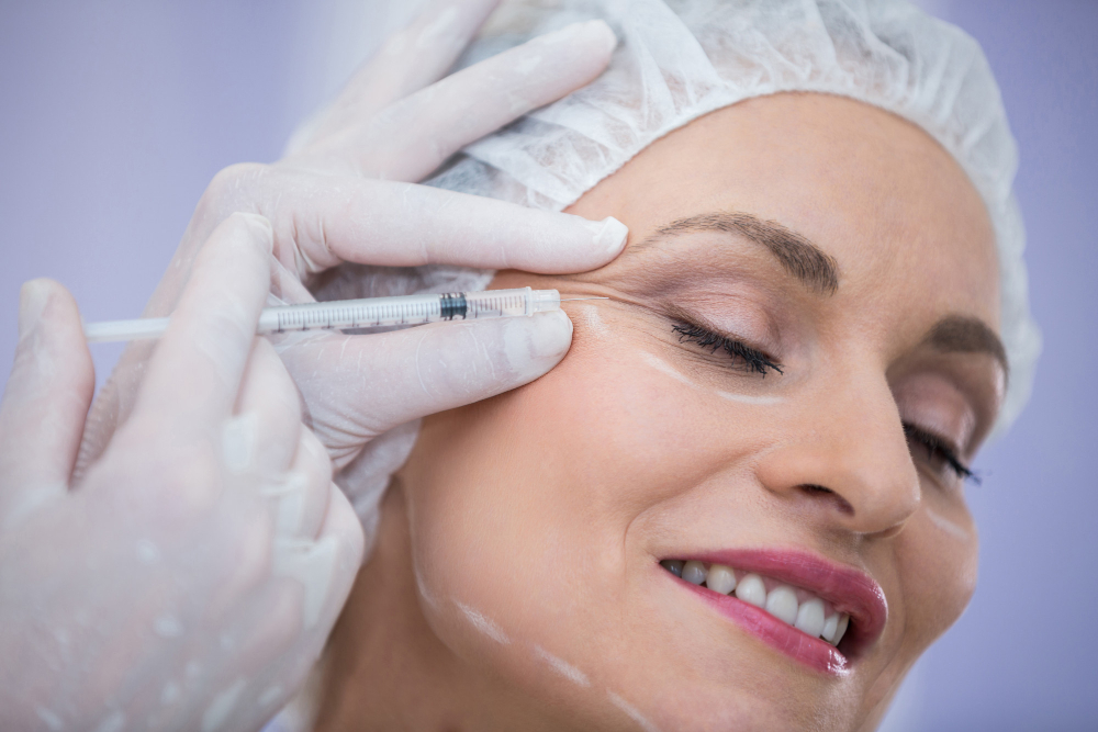 A smiling woman receiving a Botox injection near her eye, administered by a medical professional wearing gloves and a hairnet, emphasizing the careful and precise nature of the cosmetic procedure.