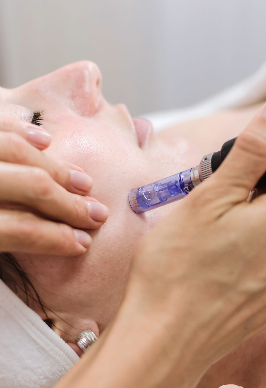 Hardware cosmetology. mesotherapy, dermapen, treatment of face zone, face rejuvenation, close up