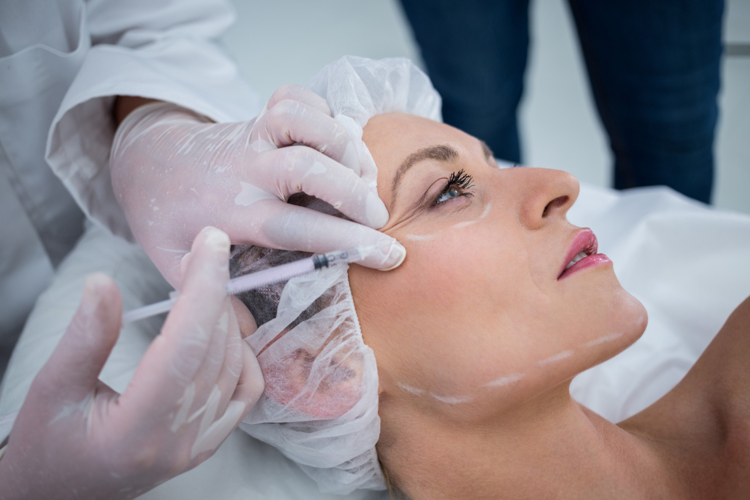 Beyond Wrinkles: The Art of Facial Sculpting with Botox
