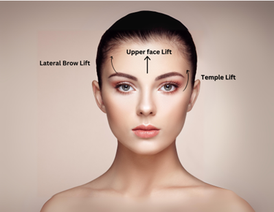 Turn Back Time: Non-Surgical Face and Neck Lifts with Botox