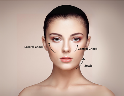 botox