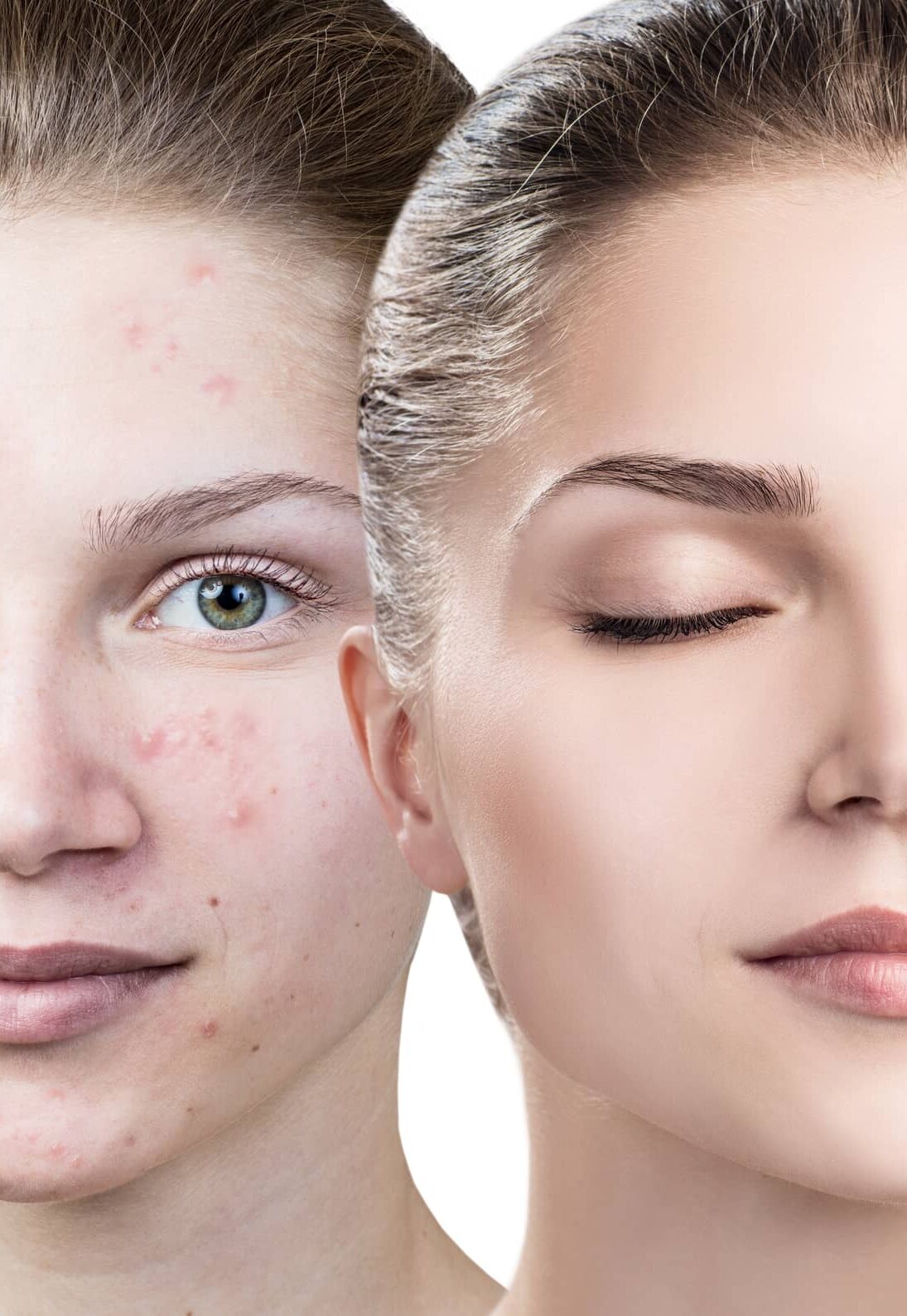 Cosmetics oil applying on face of young woman. Isolated on white.