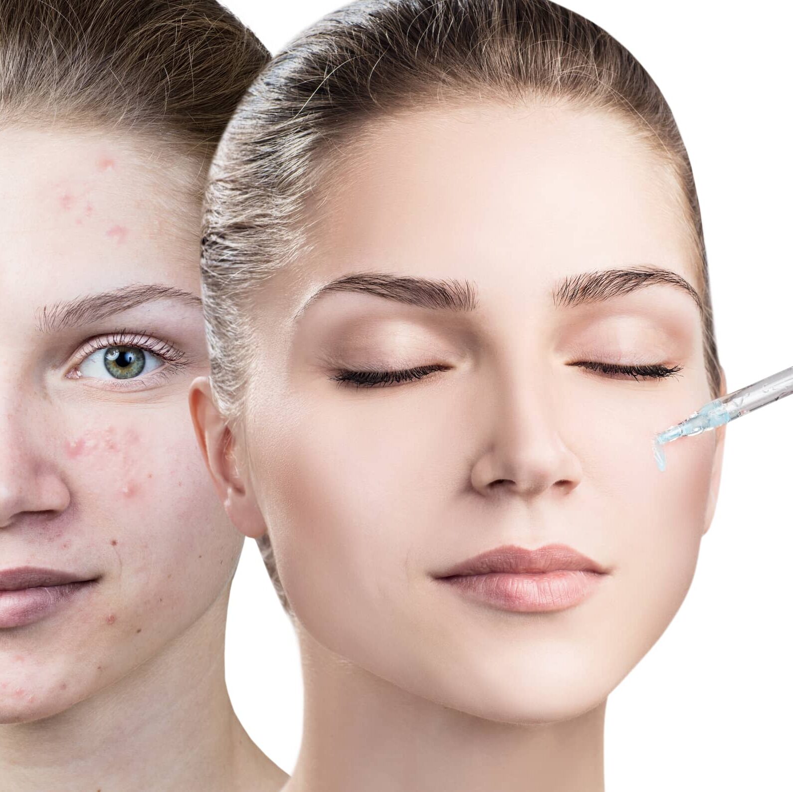 Cosmetics oil applying on face of young woman. Isolated on white.