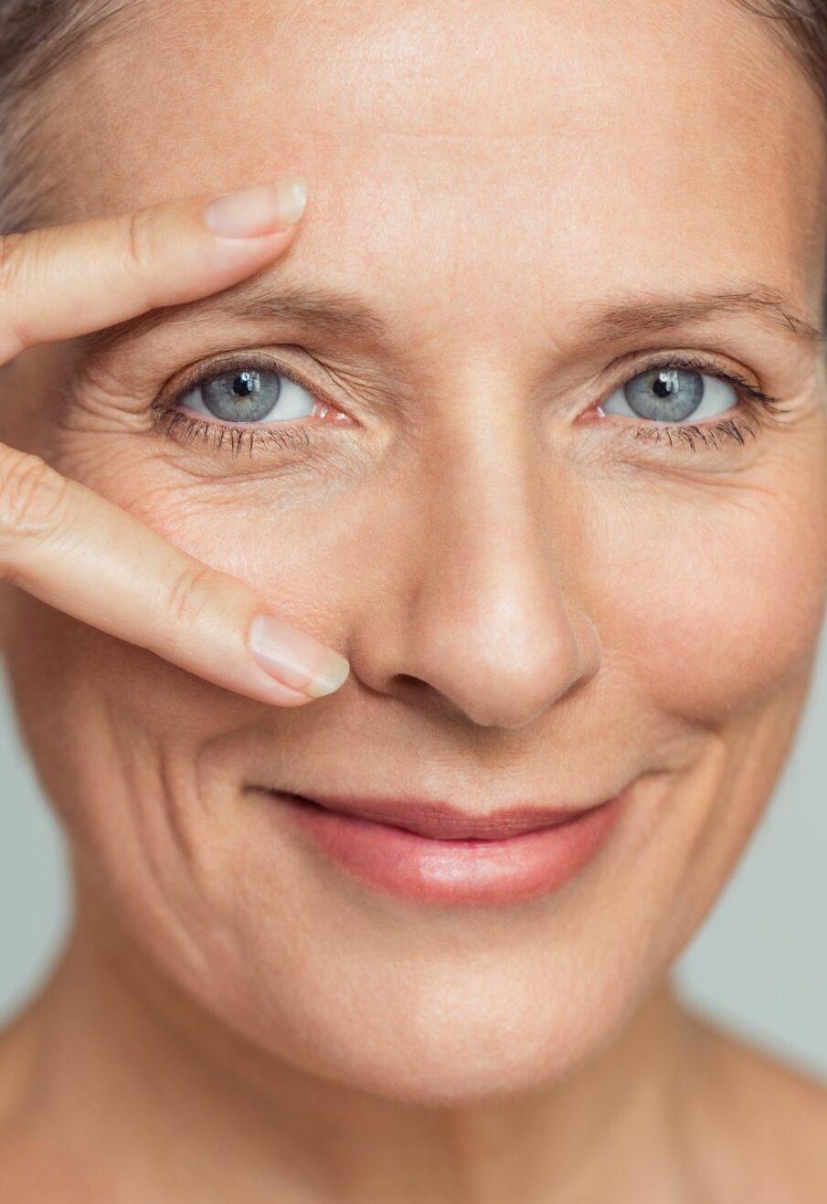 droopy-eyelid