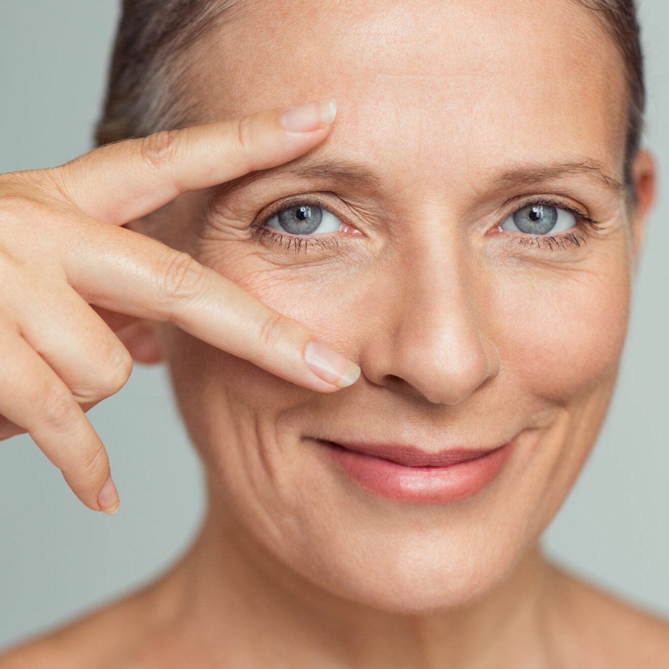 droopy-eyelid