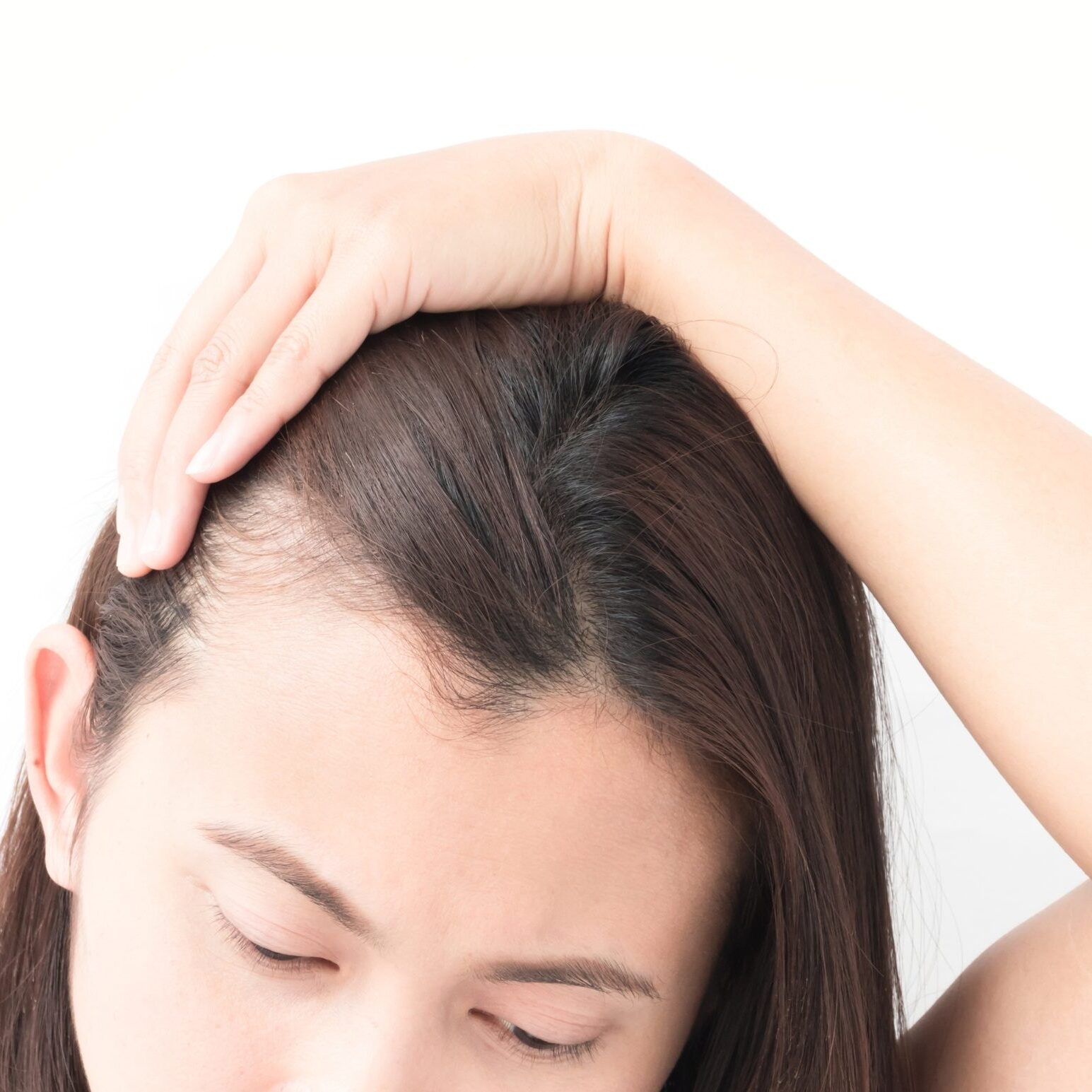 hair-loss-110121_250