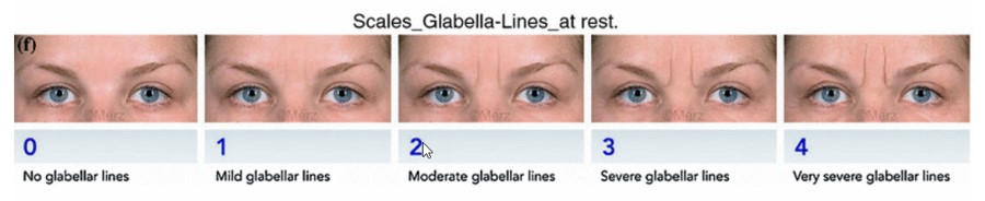 The Art of Facial Sculpting: 5 Tips for best results for Dermal Filler