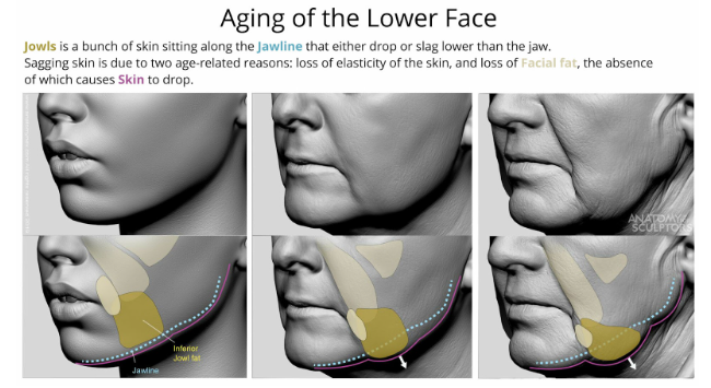 aging process for jawline - need Thread Lift